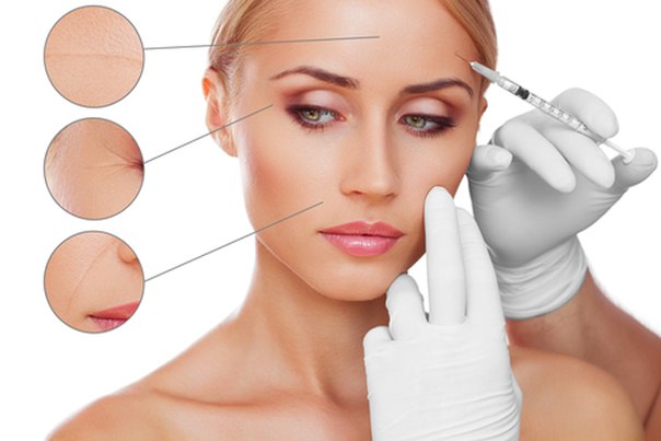 Botox Fillers